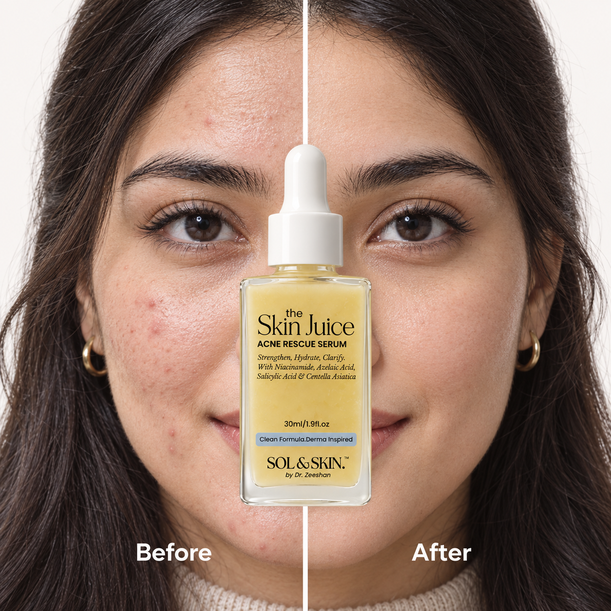 The Skin Juice Acne Rescue Serum